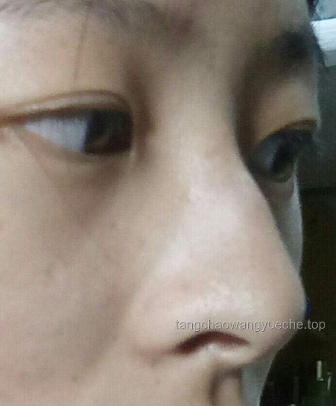 高鼻梁的标准是什么，如何判断？